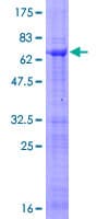 Human SPI1 / PU.1 Protein (Recombinant GST)