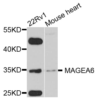 Polyclonal Rabbit anti-Human MAGEA6 Antibody (WB)