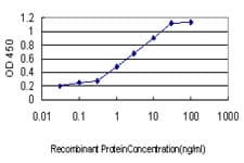 TCF3 / E2A Antibody (clone 5G2)