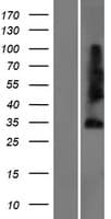 Sprouty 4 / SPRY4 Protein (Over-Expression Lysate Myc-DDK (Flag))