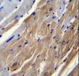 FGF16 Antibody (aa22-50)