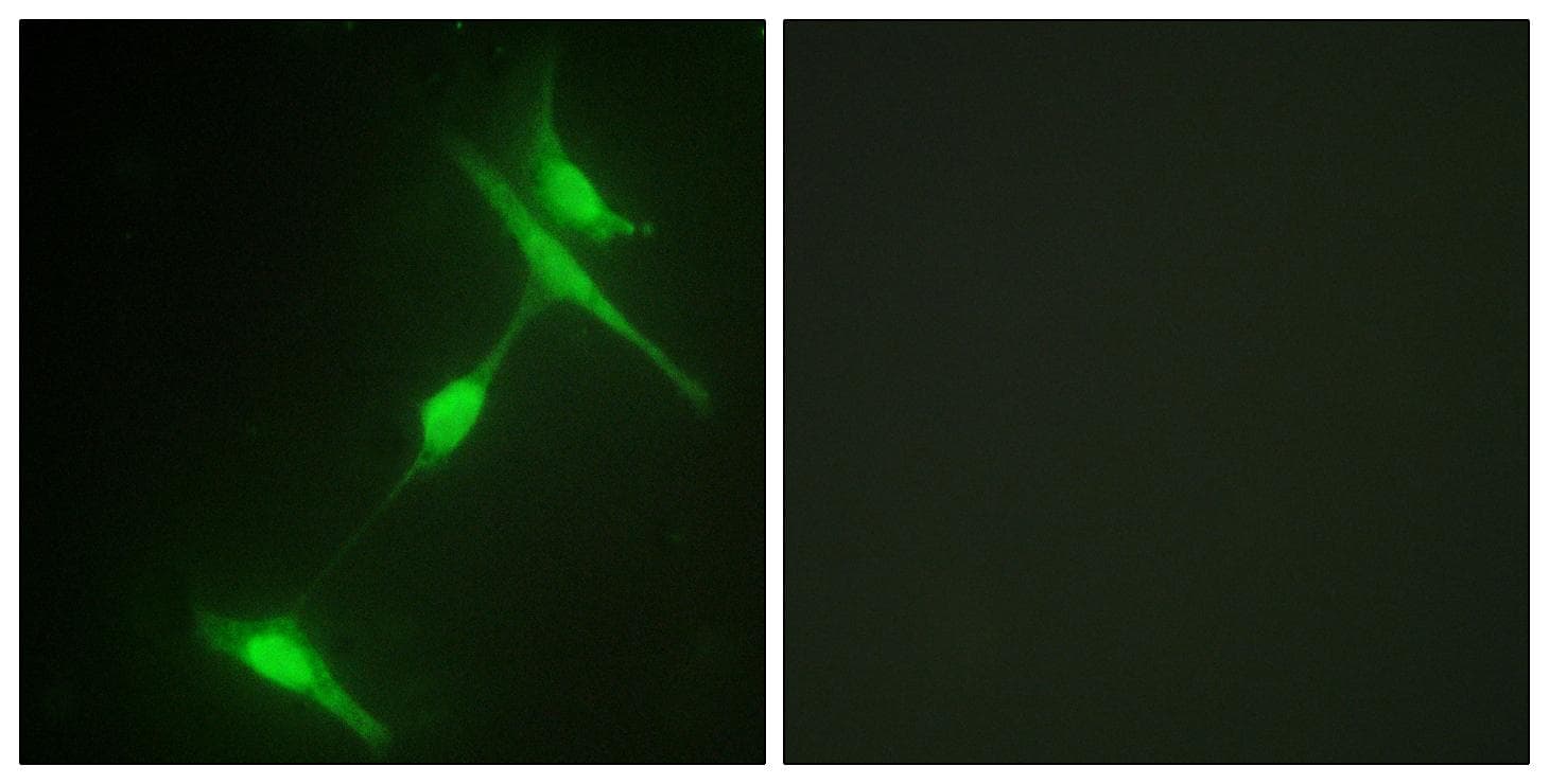 Polyclonal Rabbit anti-Human MAPK8IP1 / JIP1 Antibody (p103, IHC, IF, WB)