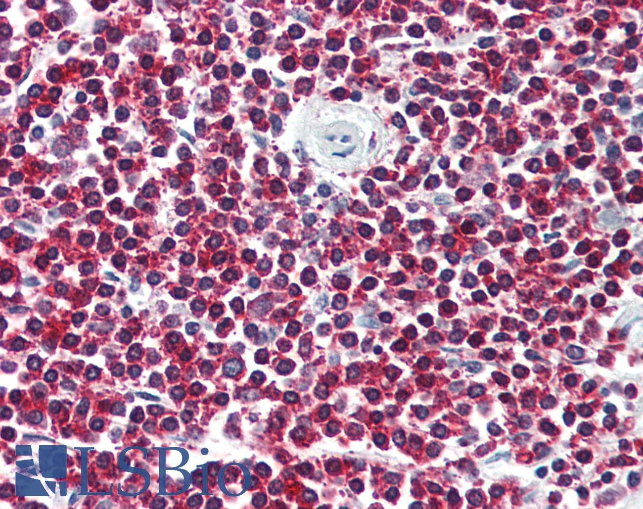 IHC-plus™ LGR6 Antibody (Internal)