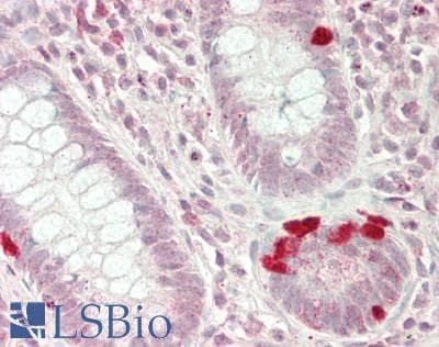 IHC-plus™ RPS7 / Ribosomal Protein S7 Antibody