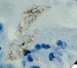 Monoclonal Mouse anti-Human Pneumocystis jiroveci Antibody (clone 3F6, Ready-to-Use, IHC)