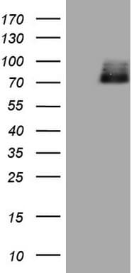 HIPK1 Antibody (aa439-697, clone OTI2C11, Carrier-free)