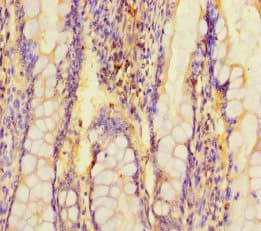 Polyclonal Rabbit anti-Human ARL15 Antibody