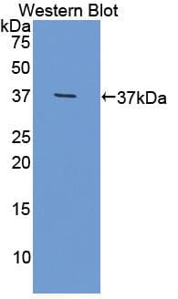 OLFM4 / Olfactomedin 4 Antibody (aa238-500, APC)