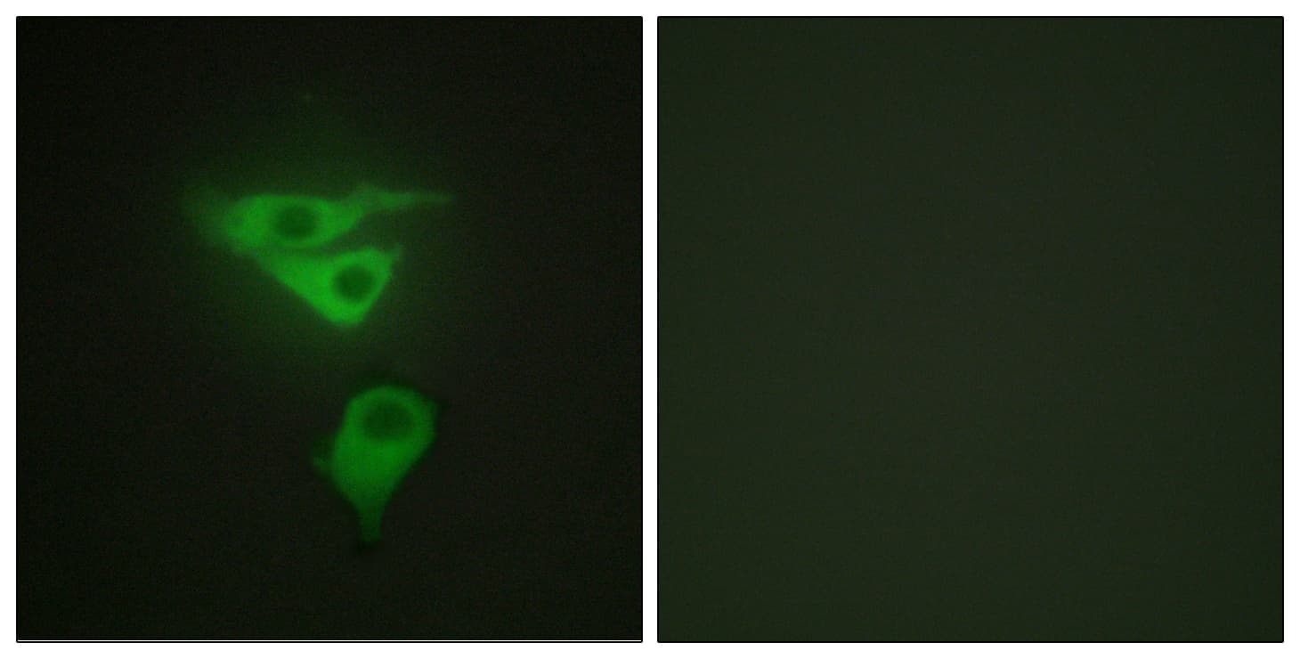 IHC-plus™ Polyclonal Rabbit anti-Human PDLIM1 Antibody (aa61-110, IHC, IF, WB)