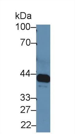 IL6R / IL6 Receptor Antibody (aa214-348)