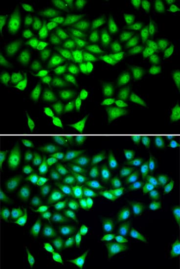 DDX21 Antibody