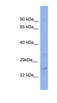 KLF16 Antibody (C-Terminus)