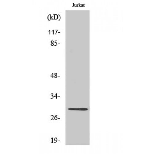 LDLRAD2 Antibody (100-180 aa, Internal)