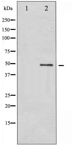 GFAP Antibody (phospho-Ser38)