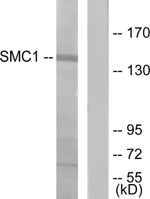 SMC1A / SMC1 Antibody (aa931-980)