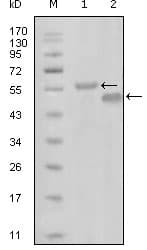 EPHA6 / EPH Receptor A6 Antibody (clone 3D5B10)