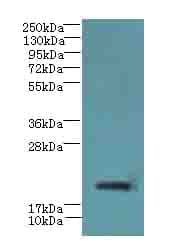 Polyclonal Rabbit anti-Human C17orf62 Antibody (IHC, WB)