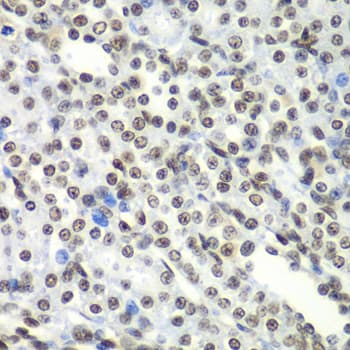 Polyclonal Rabbit anti-Human SF3B2 Antibody (IHC, IF, WB)