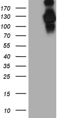 IFIH1 / MDA5 Antibody (clone OTI1C7)