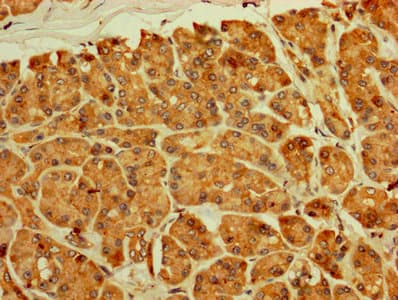 Polyclonal Rabbit anti-Human RPL11 / Ribosomal Protein L11 Antibody (IHC, IF)