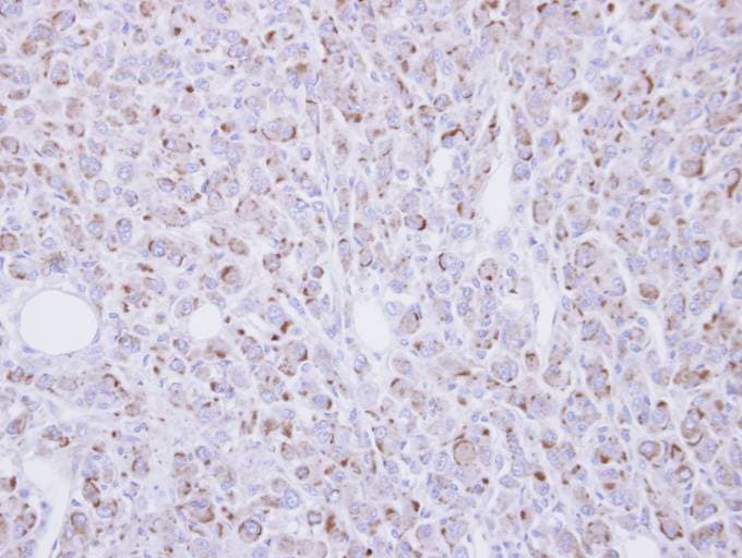 RGMB Antibody (aa178-437)