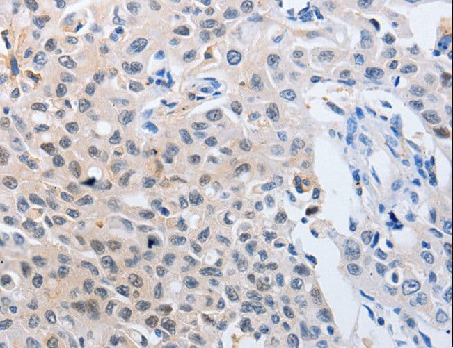Polyclonal Rabbit anti-Human YWHAQ / 14-3-3 Theta Antibody (IHC, WB)