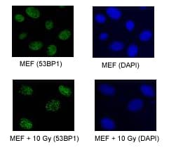 IHC-plus™ TP53BP1 / 53BP1 Antibody (aa350-400)