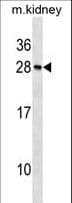 Recoverin Antibody (aa39-67)