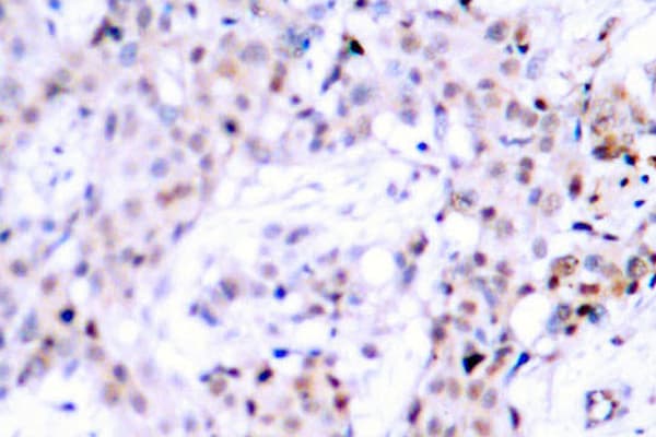 Polyclonal Rabbit anti-Human ER Alpha / Estrogen Receptor Antibody (Leu100, IHC, WB)