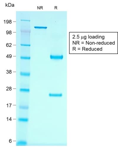PathPlus™ Recombinant Monoclonal Mouse anti-Human CDH16 / Cadherin 16 Antibody (clone rCDH16/1071, IHC, WB)