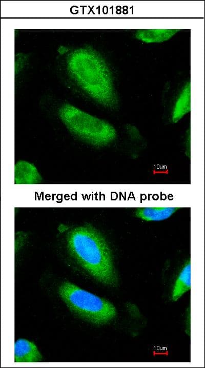 GAD1 / GAD67 Antibody (aa5-216)