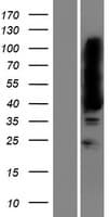 MAGEB16 Protein (Over-Expression Lysate Myc-DDK (Flag))