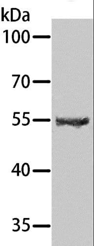 SPATA6 / SRF-1 Antibody