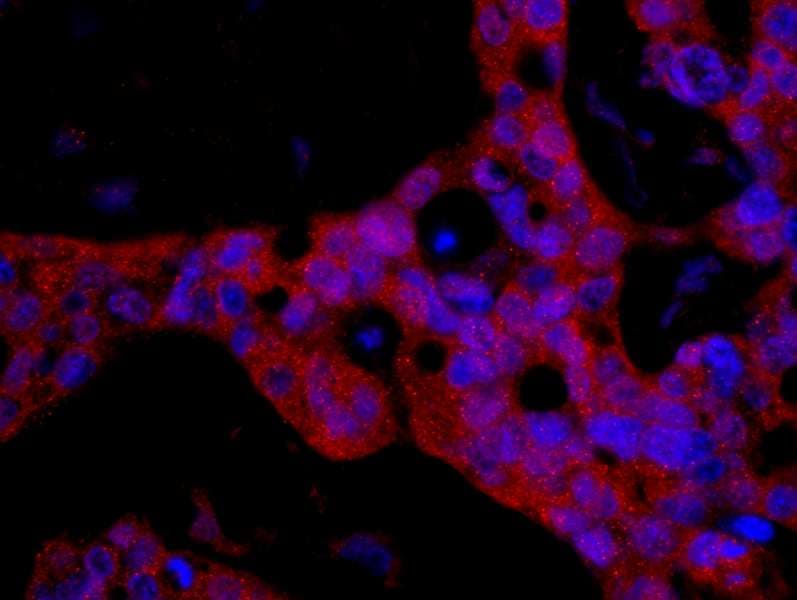 IHC-plus™ Polyclonal Rabbit anti-Human FKBP4 / FKBP52 Antibody (aa1-50, IHC, IF)