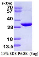 Human CUTC Protein (Recombinant His)