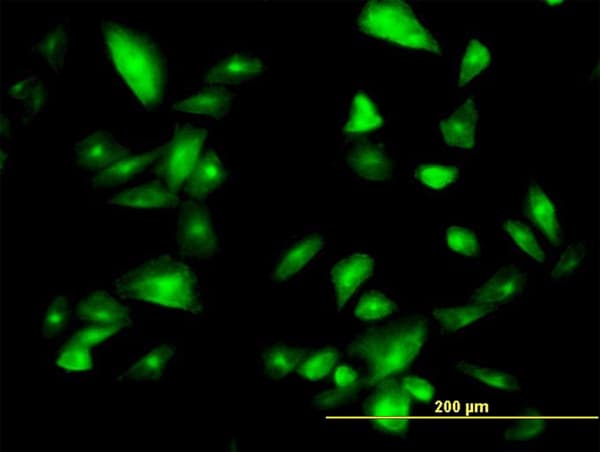 FTCD / 58K Golgi Protein Antibody (clone 3A4)