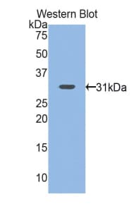 NNMT Antibody (aa1-258)