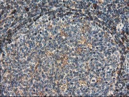 CAT / Catalase Antibody (clone OTI1B8)