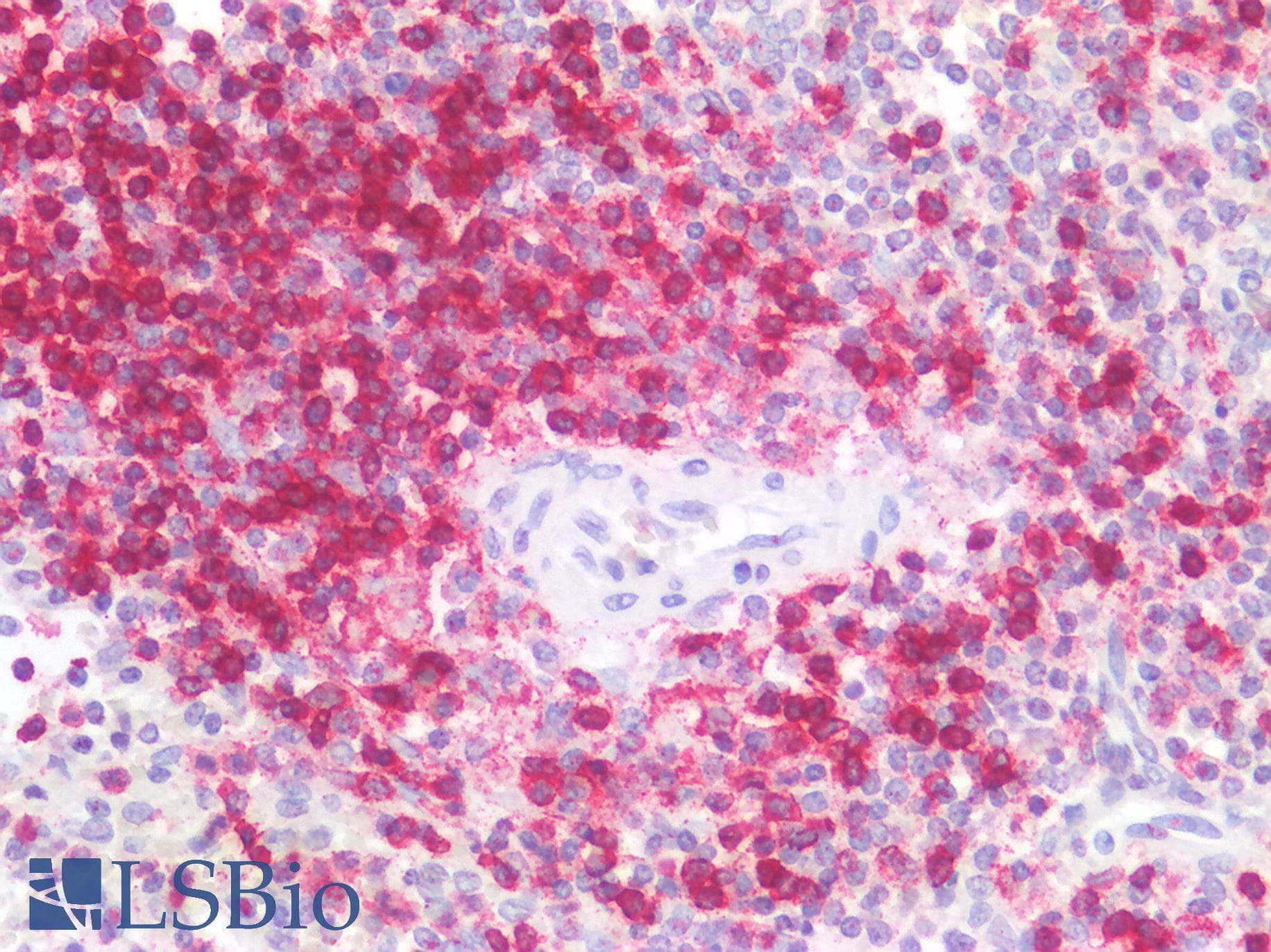 PathPlus™ CD45RO Antibody (clone 4KB5)
