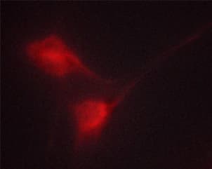 CML / BCR Antibody (phospho-Tyr360)