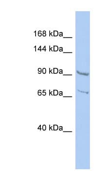 Polyclonal Rabbit anti-Human RALGDS Antibody (aa107-156, WB)
