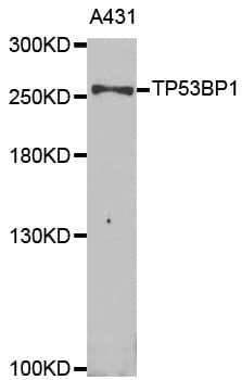 Polyclonal Rabbit anti-Human TP53BP1 / 53BP1 Antibody (IHC, IF, WB)