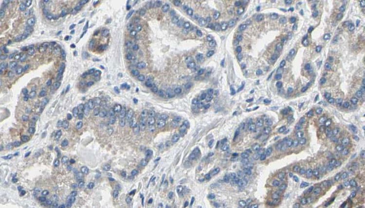 Thymidylate Kinase Antibody