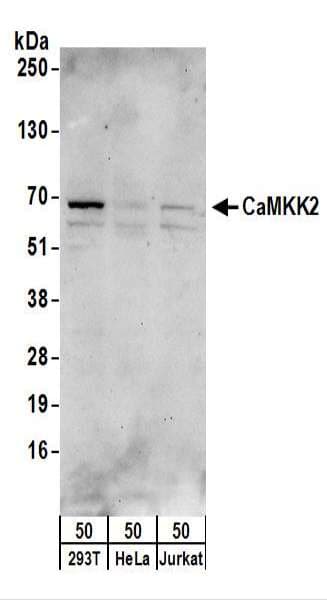 CAMKK2 Antibody (aa538-588)