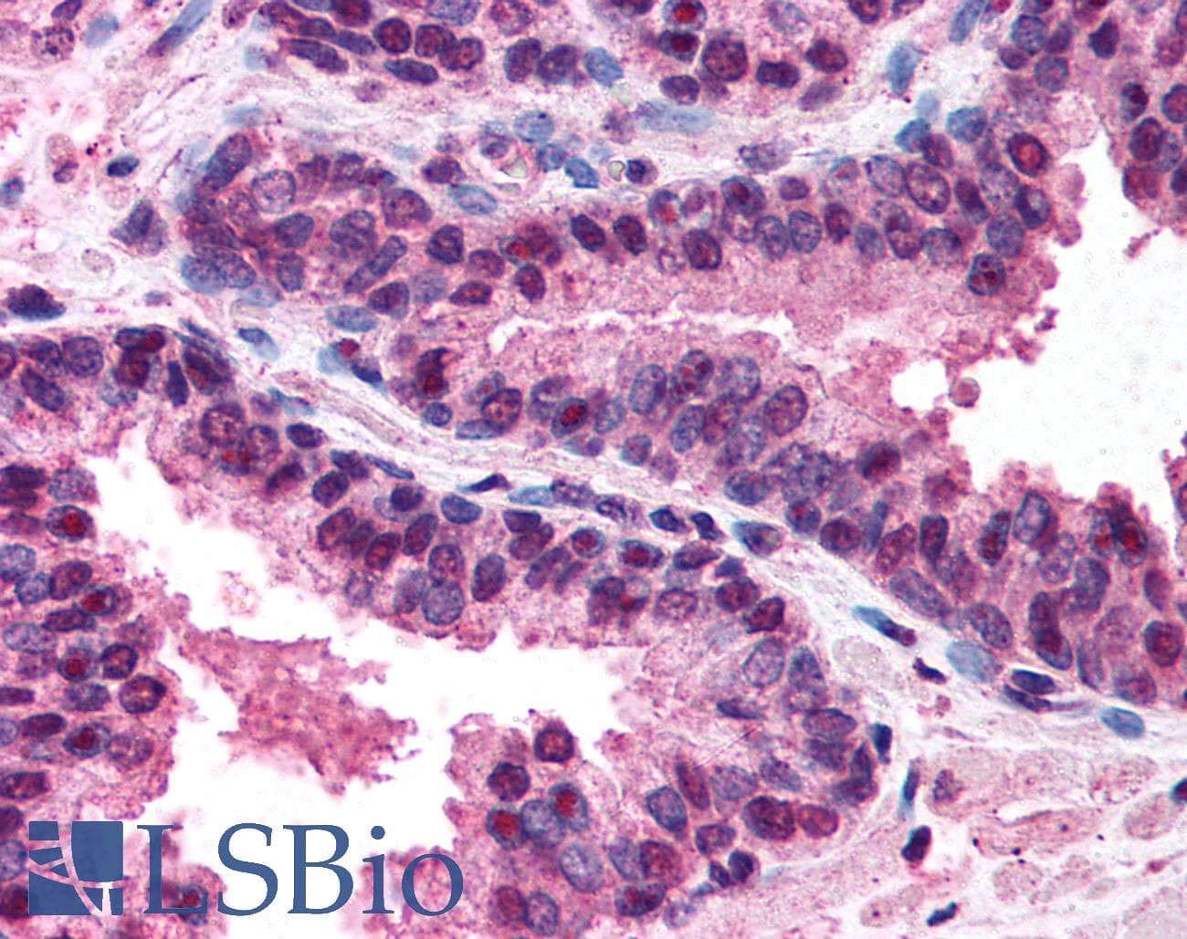 TNFRSF10B / Killer / DR5 Antibody