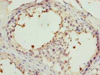 Polyclonal Rabbit anti-Human PPP1R7 Antibody