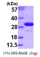 Human KHK / Ketohexokinase Protein (Recombinant)