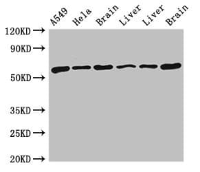TH / Tyrosine Hydroxylase Antibody (aa2-197)