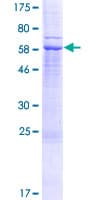 Human RARRES1 Protein (Recombinant GST)
