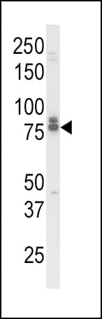 AcPL / IL18RAP Antibody (aa73-101)